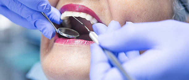Best Knocked-Out Tooth (Avulsed Tooth) Treatment in Lake Heritage, PA